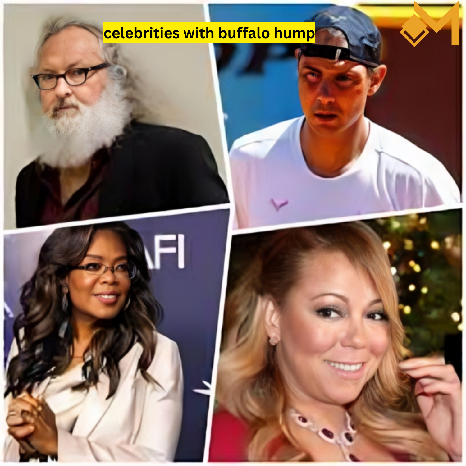 celebrities with buffalo hump