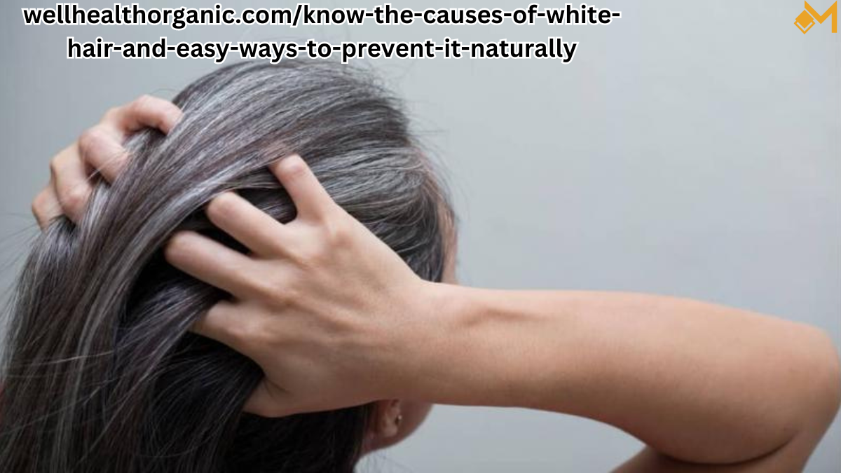 wellhealthorganic.com/know-the-causes-of-white-hair-and-easy-ways-to-prevent-it-naturally